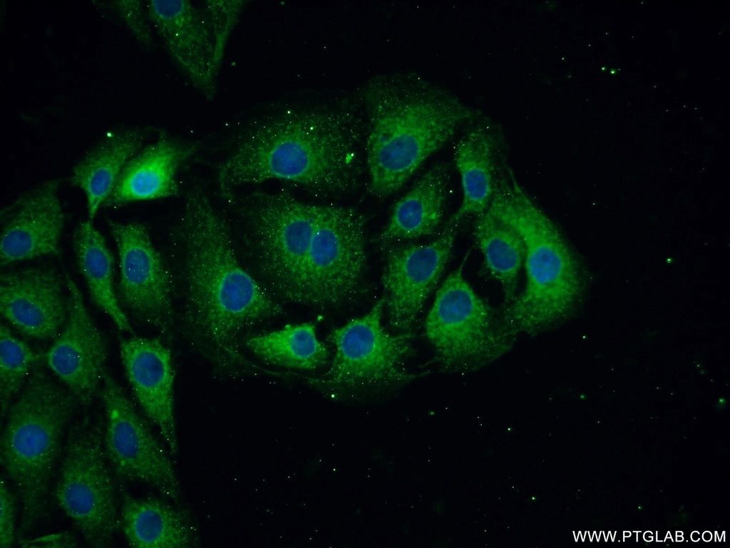 NF-L Polyclonal antibody