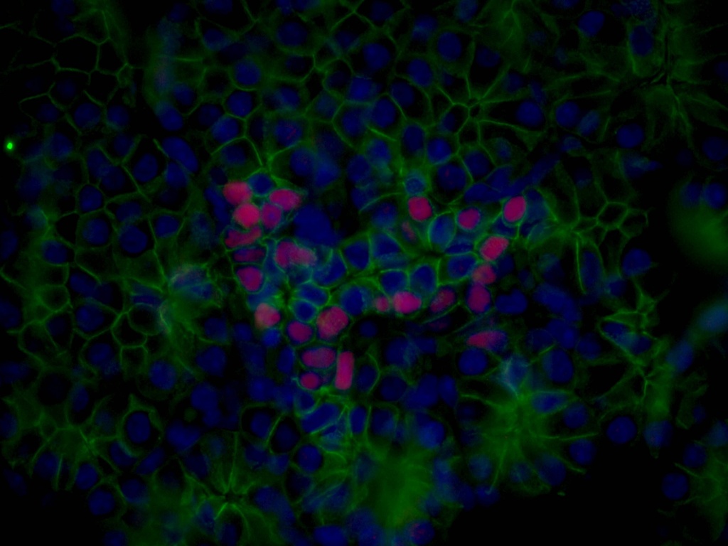 NKX2-2 Polyclonal antibody