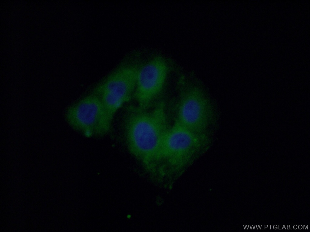 SACM1L Polyclonal antibody