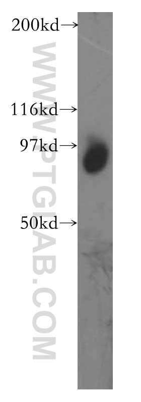 TGS1 Polyclonal antibody