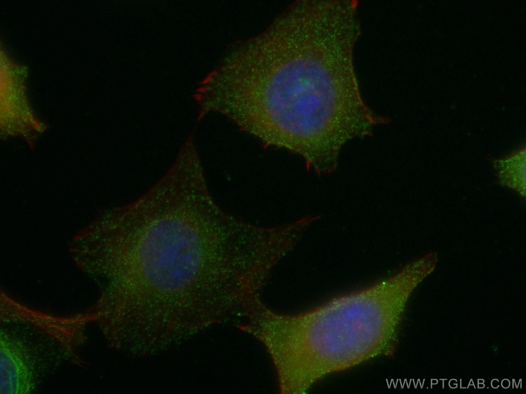 TRIM37 Polyclonal antibody