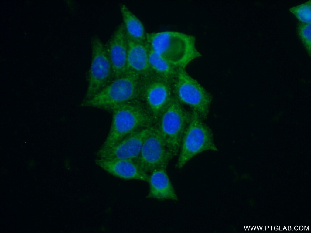 GNS Polyclonal antibody