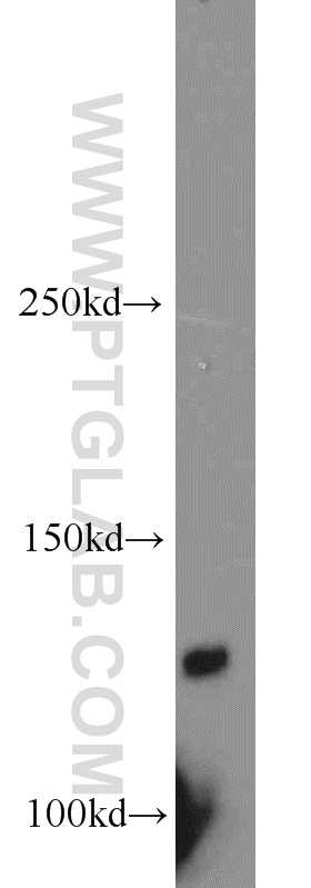 PLEKHA5 Polyclonal antibody