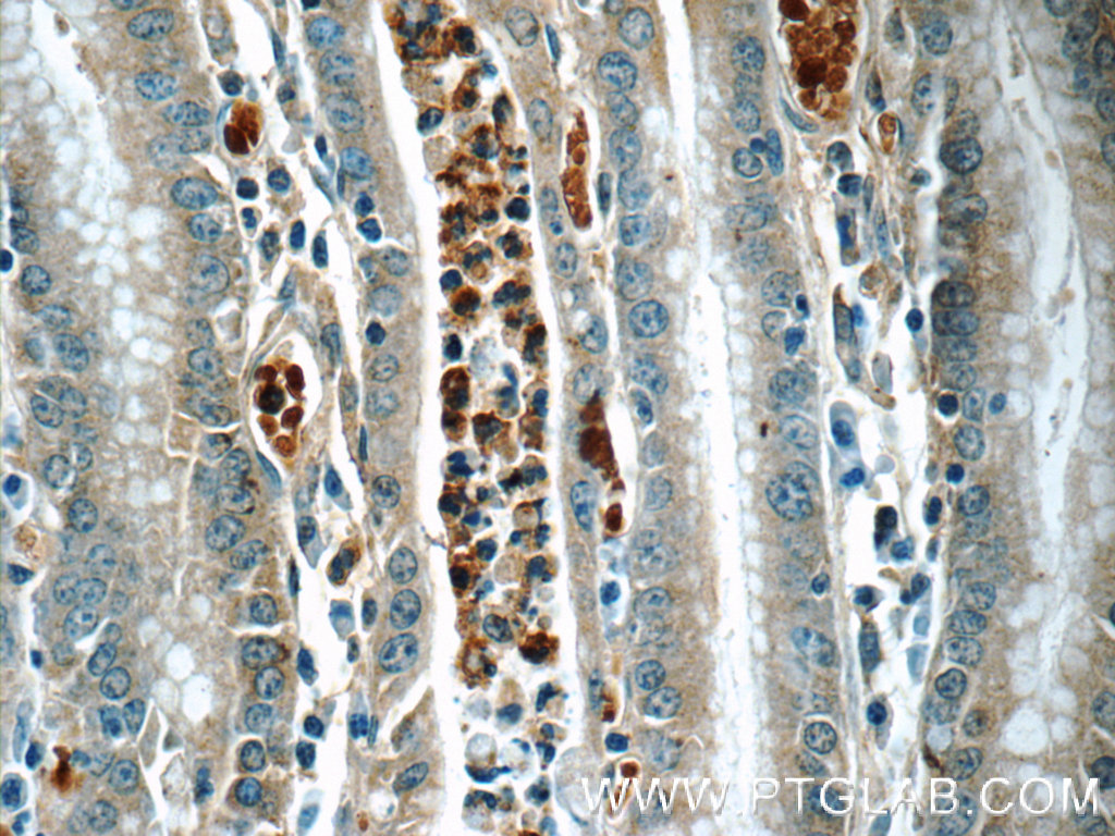 ARL8B Polyclonal antibody