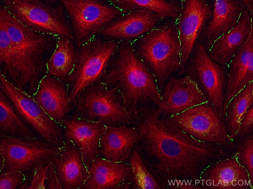 Claudin 1 Polyclonal antibody