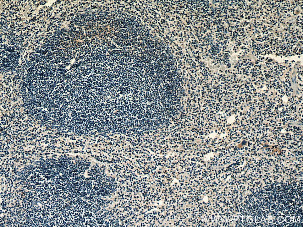 RAB37 Polyclonal antibody