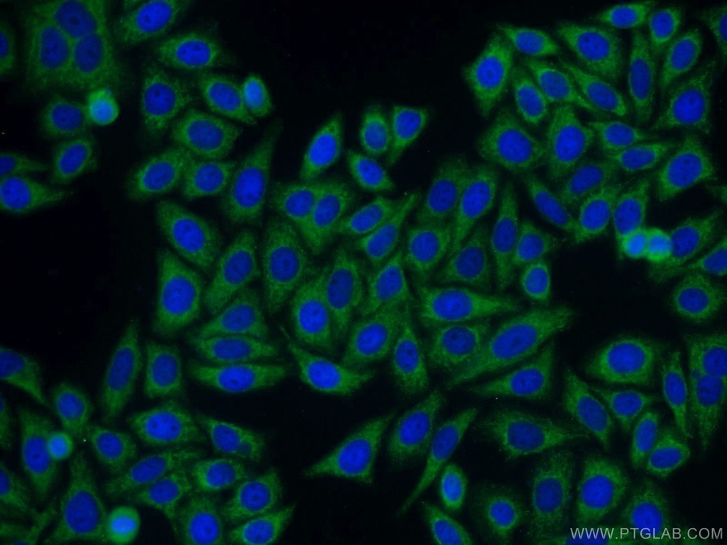 SAMSN1 Polyclonal antibody