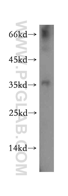 NKX3-1 Polyclonal antibody