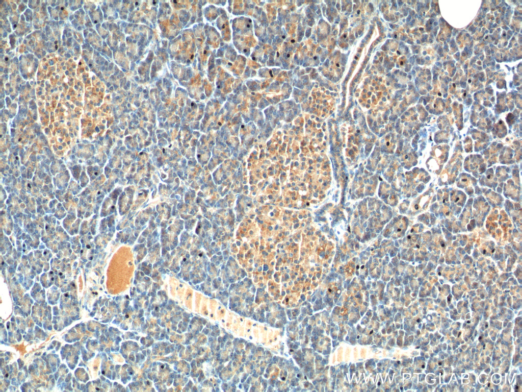 CCK Polyclonal antibody