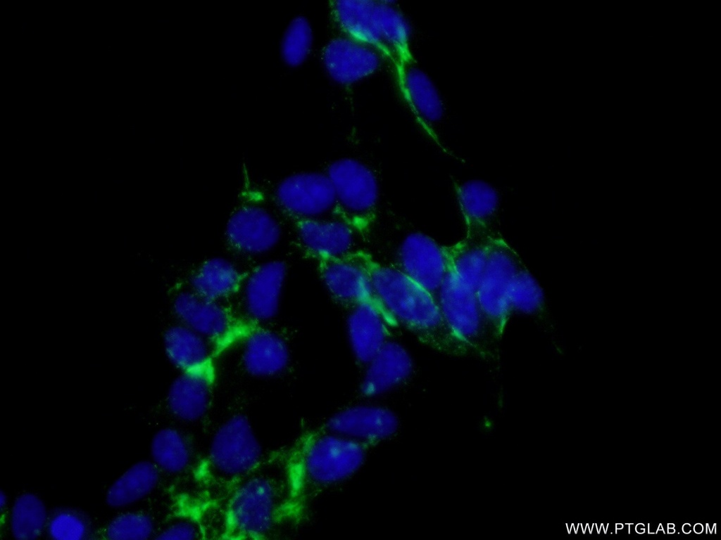 CTNS Polyclonal antibody