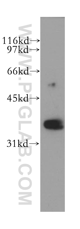 RHOXF2 Polyclonal antibody