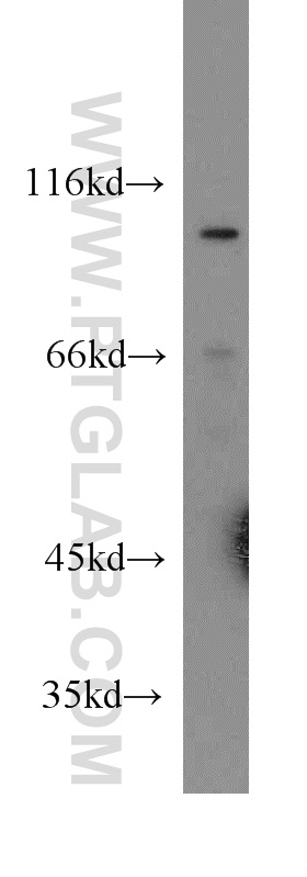Cadherin-18 Polyclonal antibody