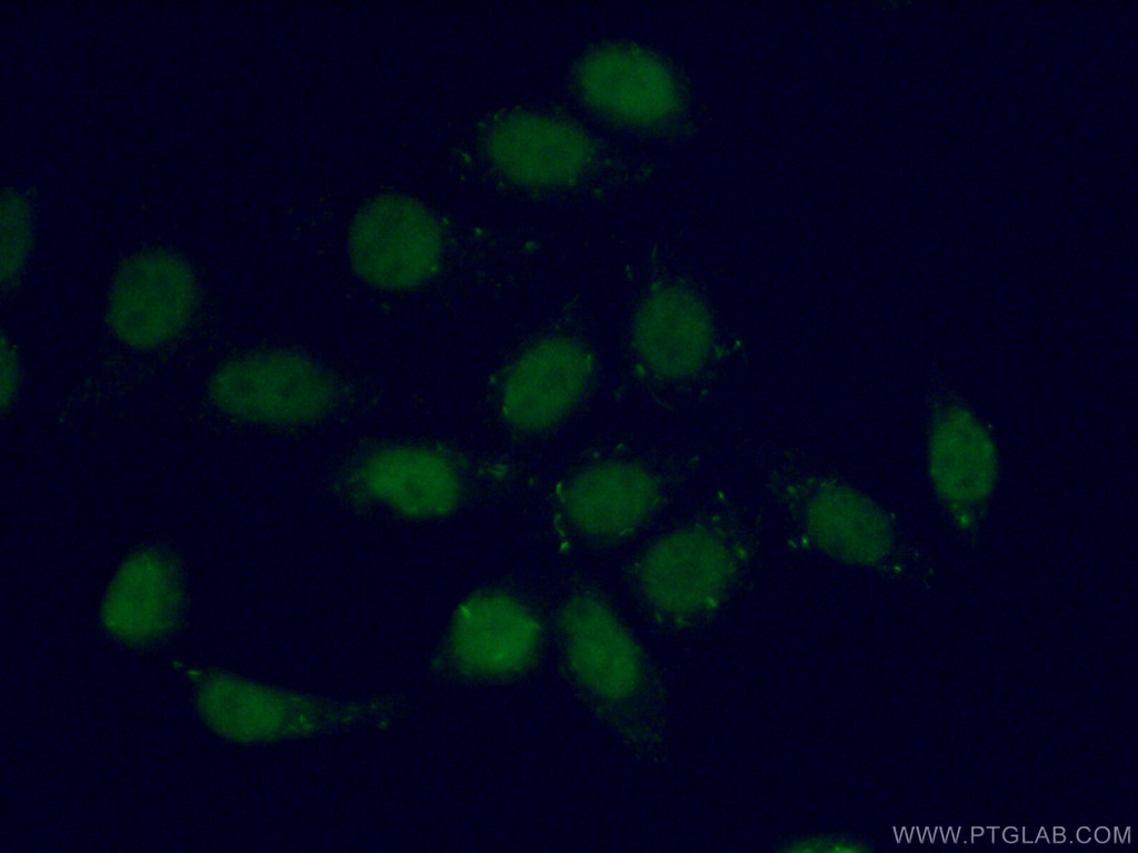 TEAD3 Polyclonal antibody
