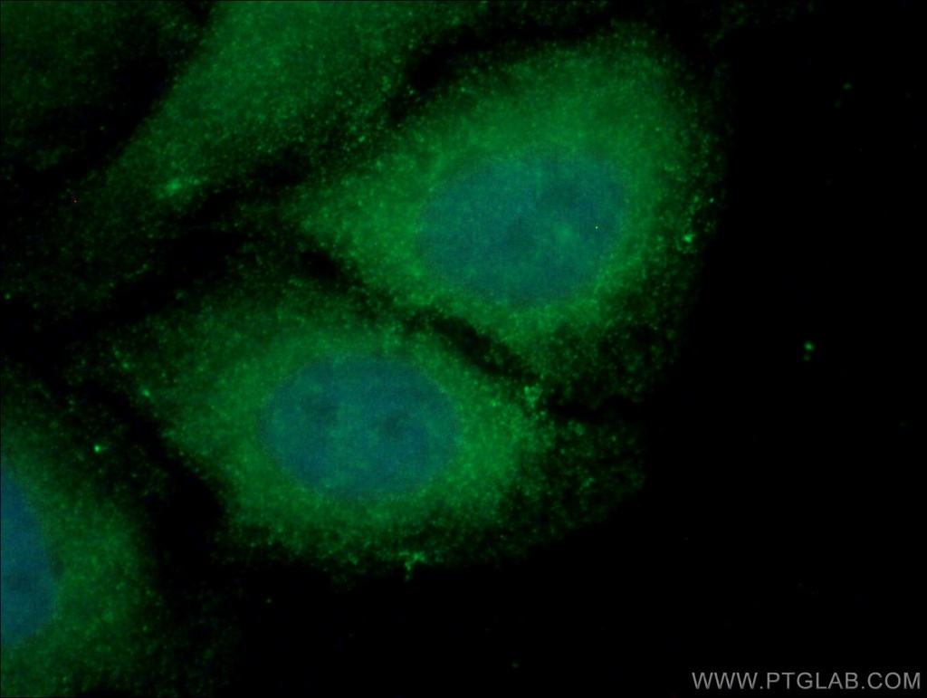 USP24 Polyclonal antibody