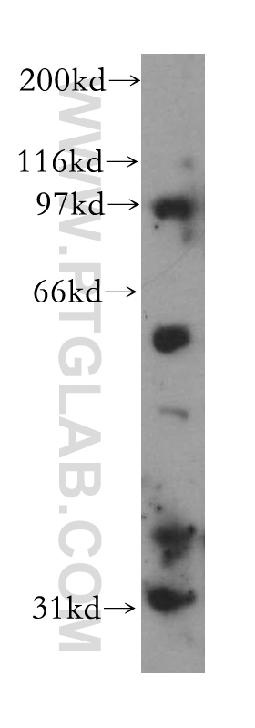 CHST9 Polyclonal antibody