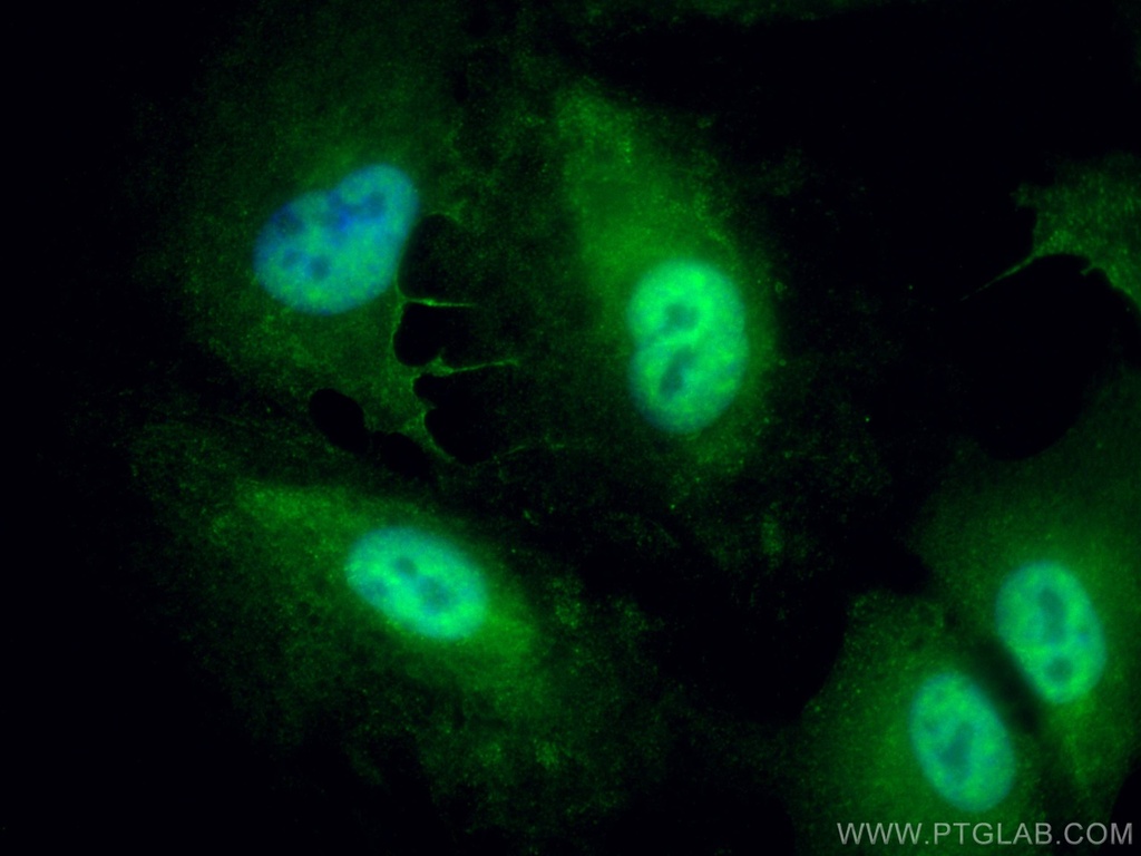 UGDH Polyclonal antibody