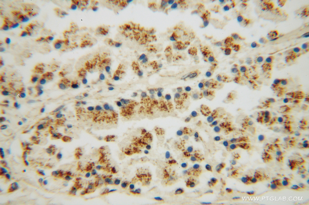 DHX36 Polyclonal antibody