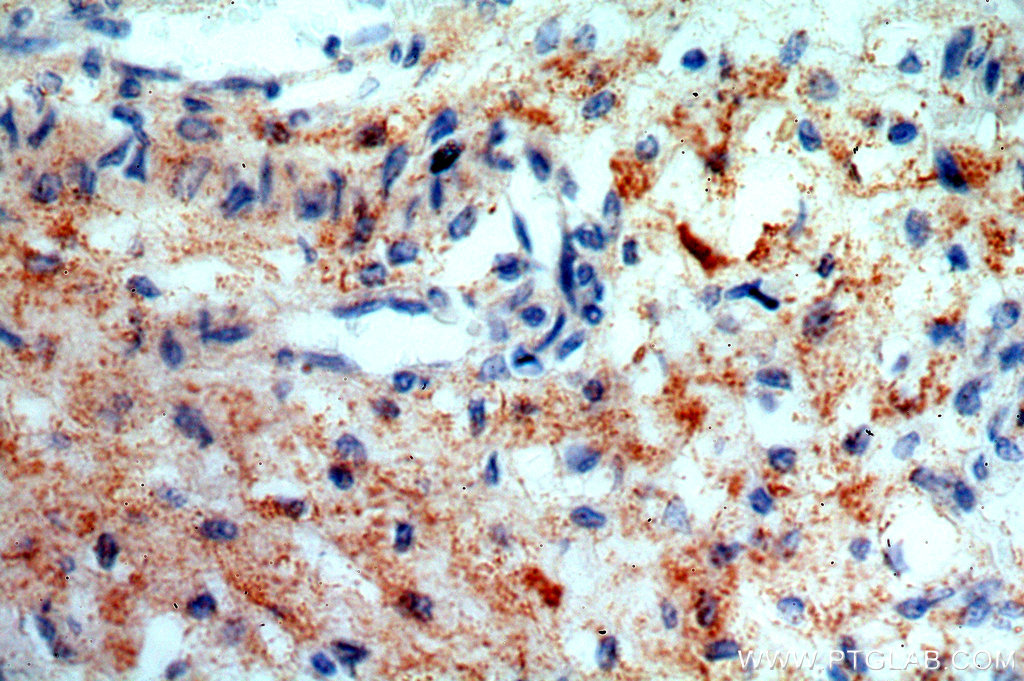 SNX20 Polyclonal antibody