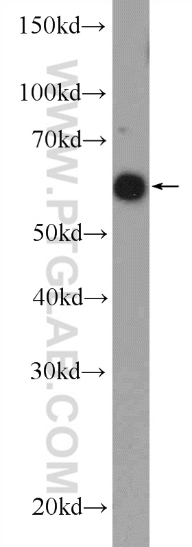 RBBP5 Polyclonal antibody