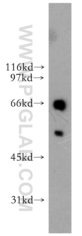 ETV6 Polyclonal antibody