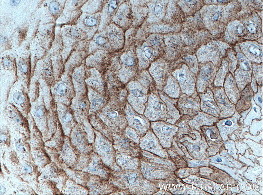 CDSN Polyclonal antibody
