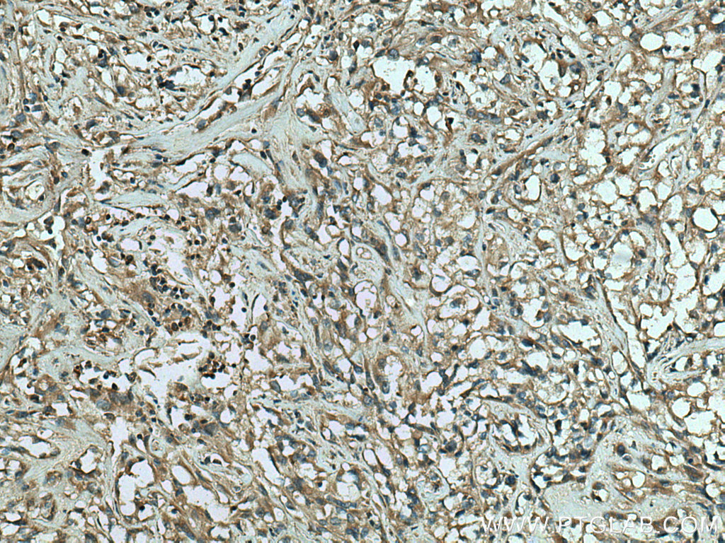 RAB25 Polyclonal antibody