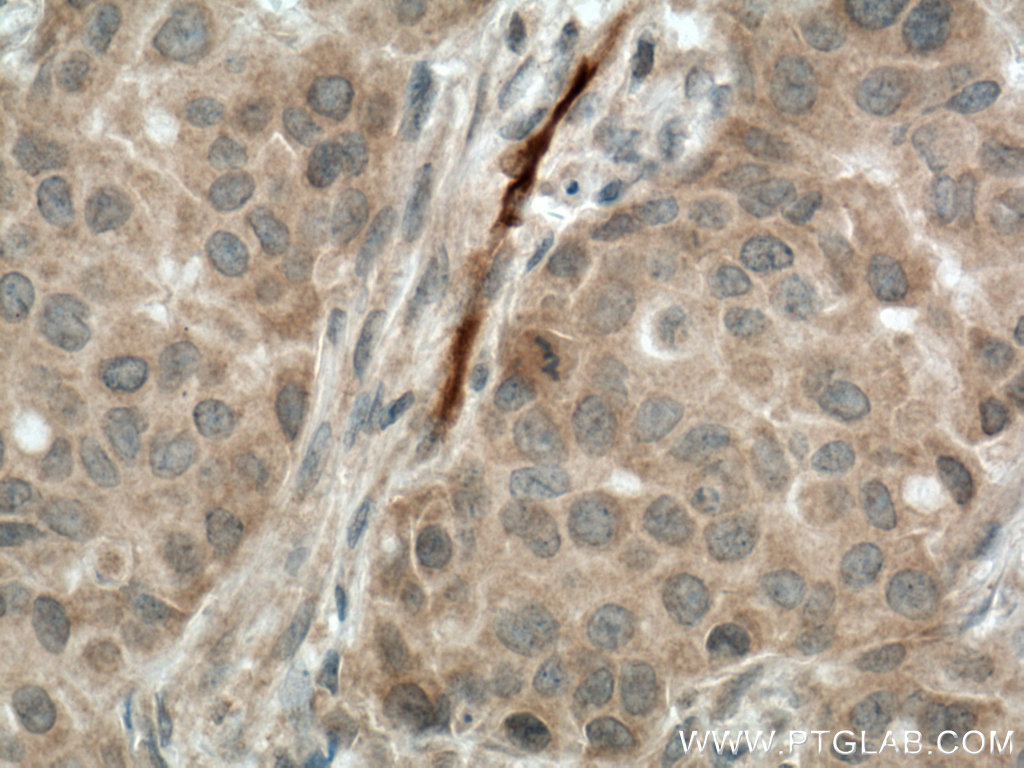 CA1 Polyclonal antibody