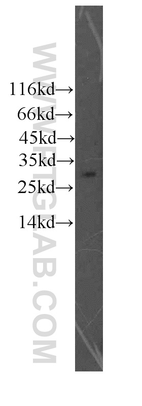 Granzyme M Polyclonal antibody