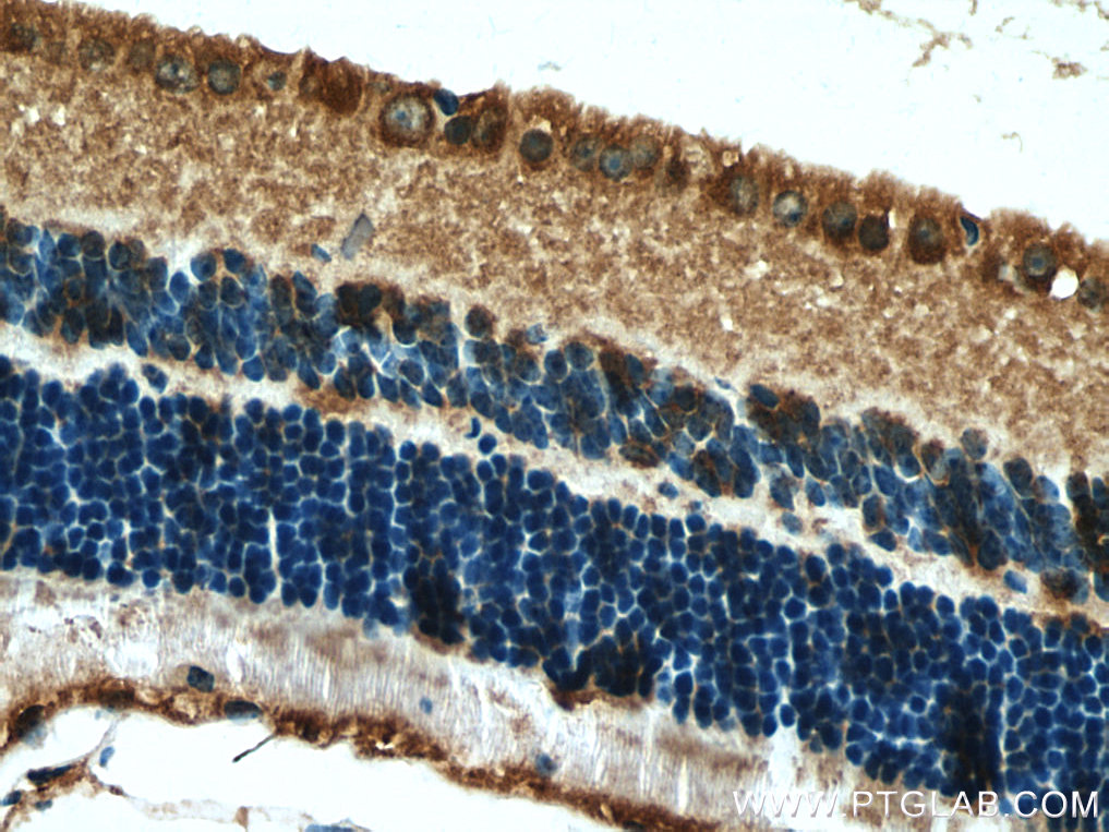 RPGRIP1 Polyclonal antibody