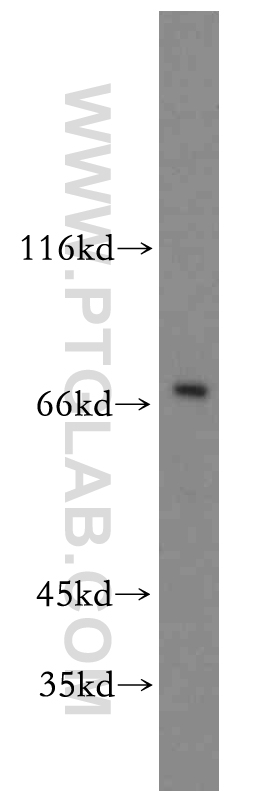 SOX5 Polyclonal antibody