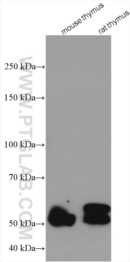 RCBTB2 Polyclonal antibody