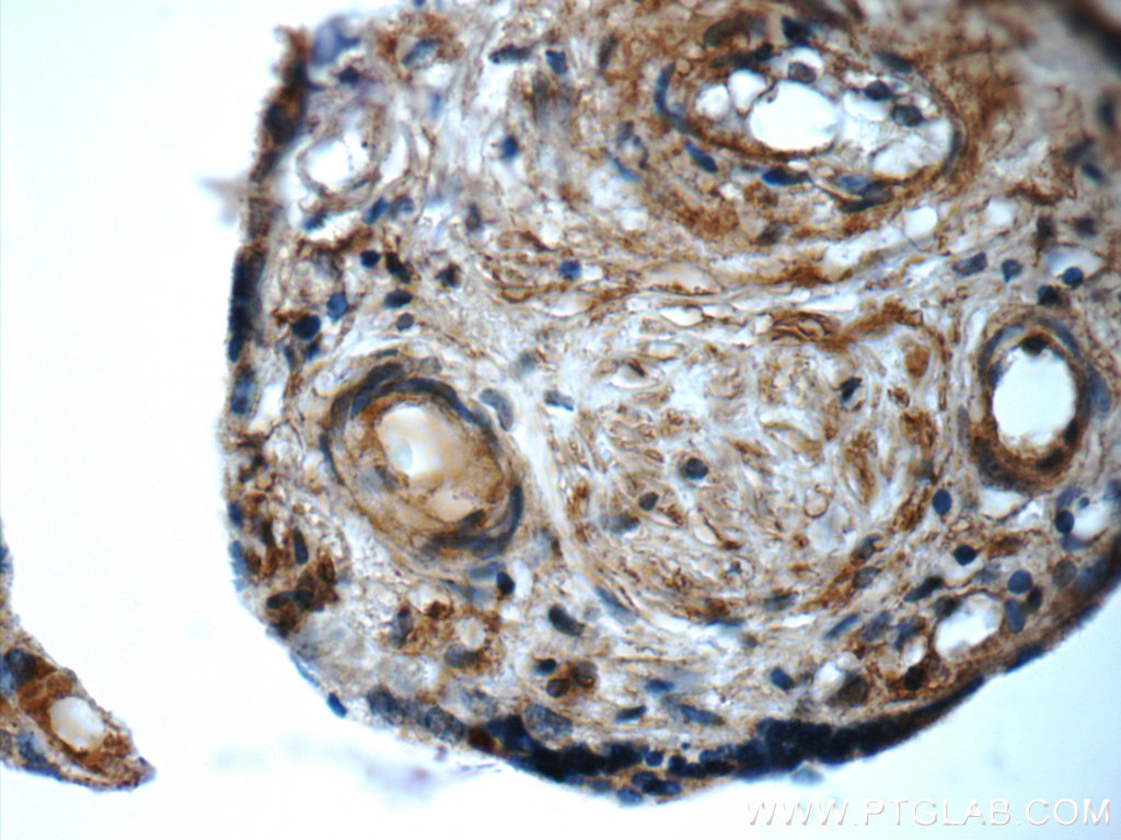 ARSB Polyclonal antibody