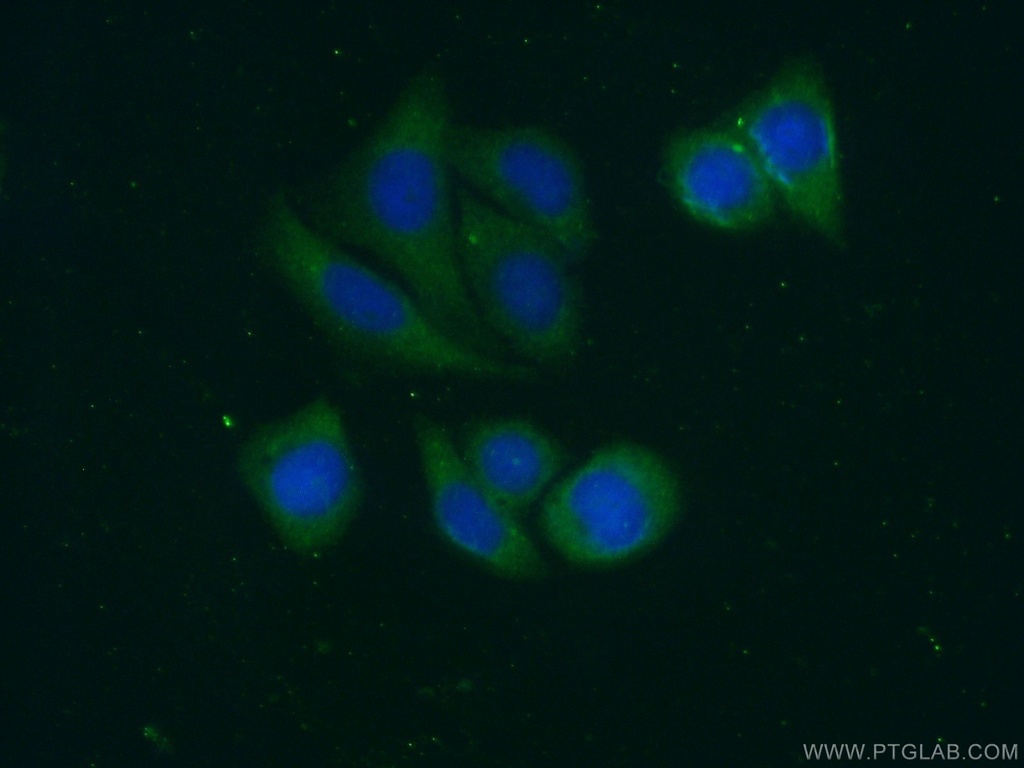 Alpha 2-Antiplasmin Polyclonal antibody