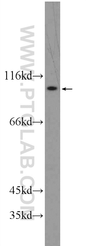 ATP12A Polyclonal antibody