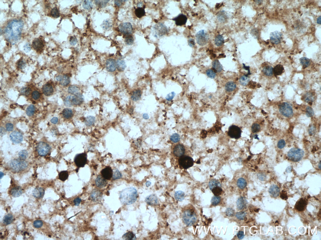 ASPA Polyclonal antibody