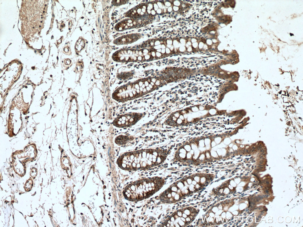 BMP5 Polyclonal antibody