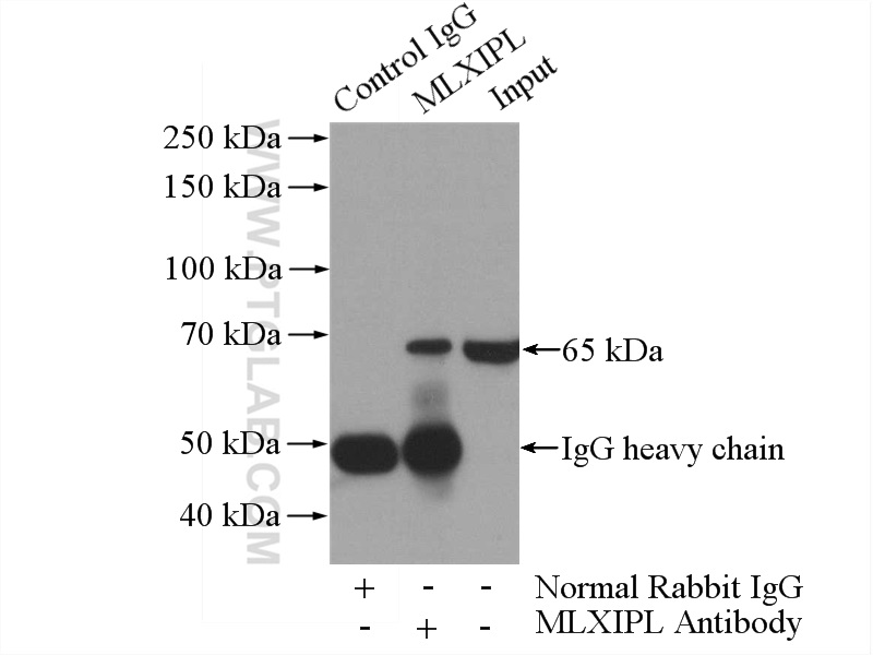 MLXIPL Polyclonal antibody