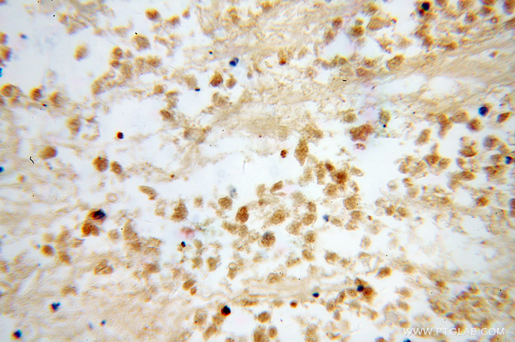 DLX3 Polyclonal antibody
