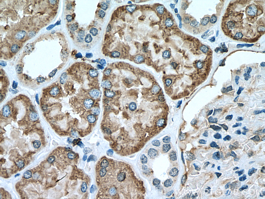 GGH Polyclonal antibody