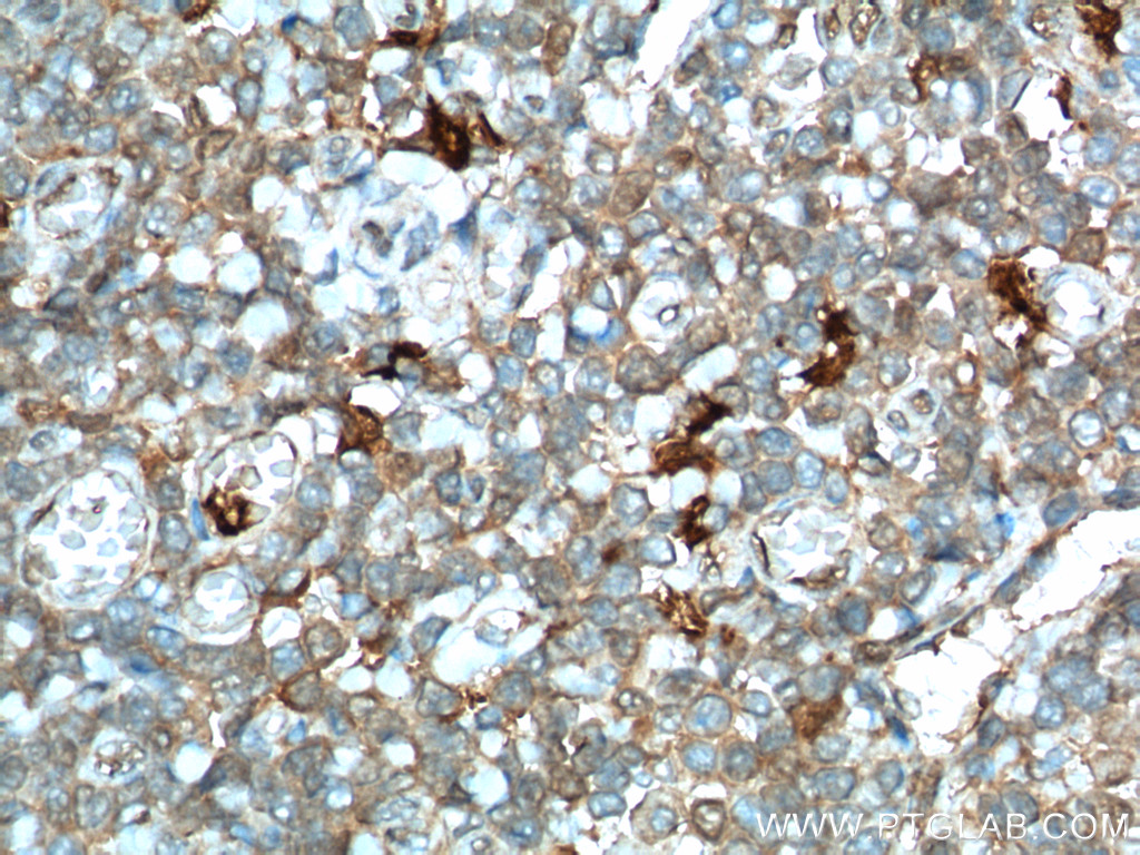 IDO1 Polyclonal antibody