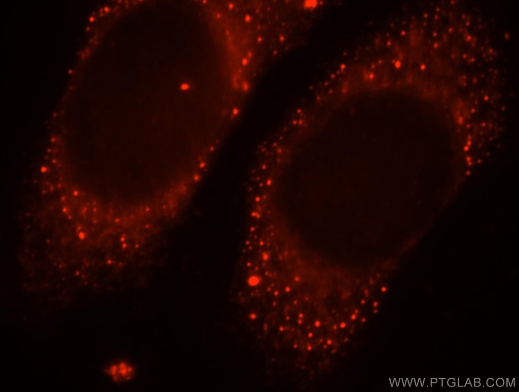 MPPED2 Polyclonal antibody