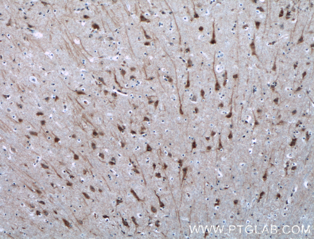 NGEF Polyclonal antibody