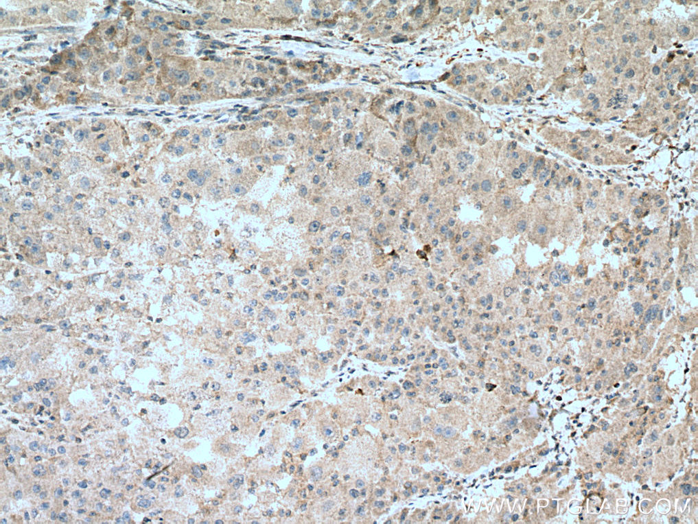 ZBP1 Polyclonal antibody