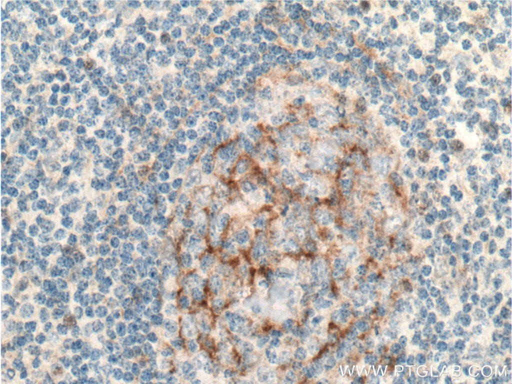 IL-12RB1 Polyclonal antibody