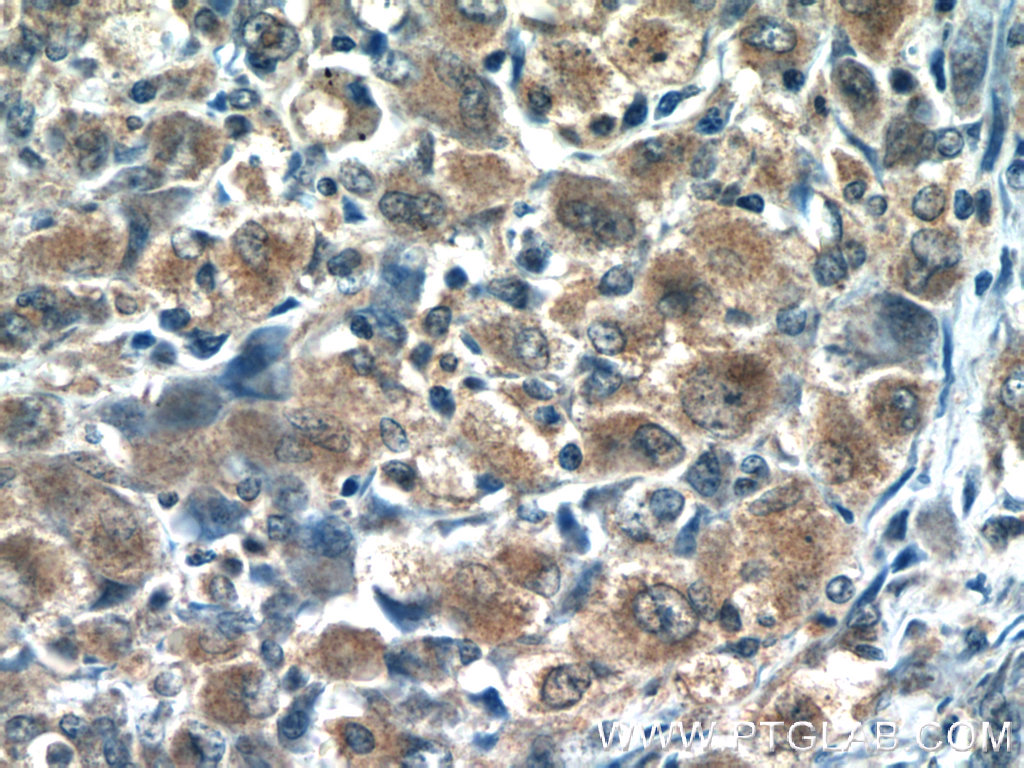 RNF125 Polyclonal antibody