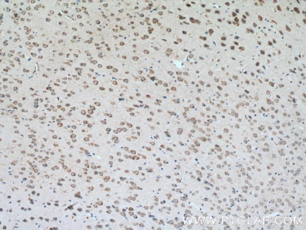 CLSTN3 Polyclonal antibody