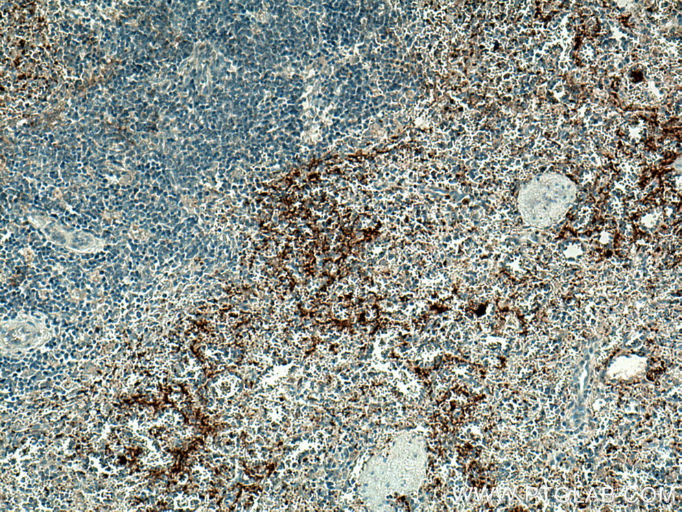 P-selectin Polyclonal antibody