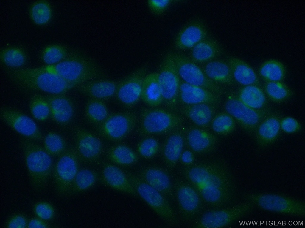 ATP2C1 Polyclonal antibody