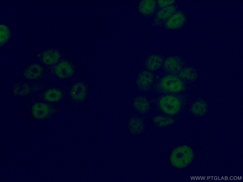 GMEB2 Polyclonal antibody