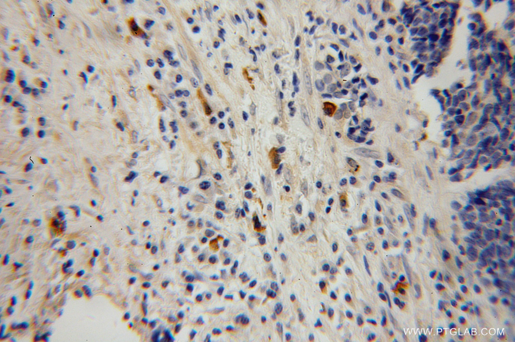 HK3 Polyclonal antibody